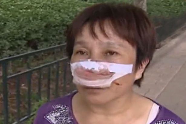 MAIN nose - Женщина лишилась носа за то, что слишком долго не подходила к телефону