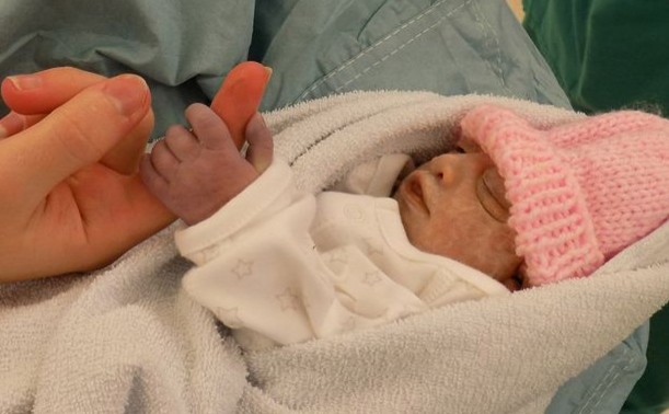 Screenshot 2 - Девочка, прожившая всего 74 минуты после рождения, стала самым молодым донором органов в Англии