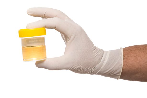 Urine Test - Британские ученые создали нанотопливо, работающее на человеческой моче